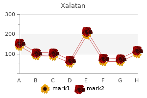 buy xalatan 2.5 ml amex