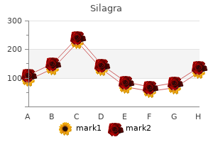 silagra 50 mg quality
