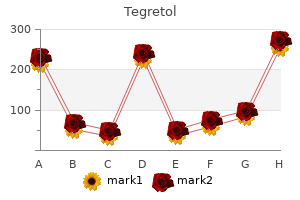 buy tegretol 100 mg cheap
