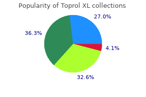 buy generic toprol xl 50 mg line