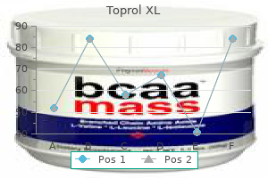 50 mg toprol xl order with amex