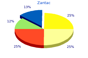 zantac 150 mg buy otc