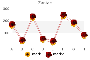 zantac 300 mg online