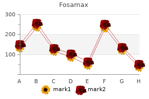 buy fosamax 35 mg with visa