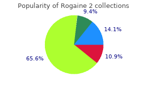 60 ml rogaine 2 generic free shipping