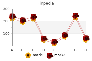 1 mg finpecia generic mastercard