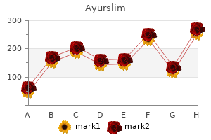 ayurslim 60 caps buy generic on-line