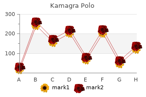 discount kamagra polo 100 mg line