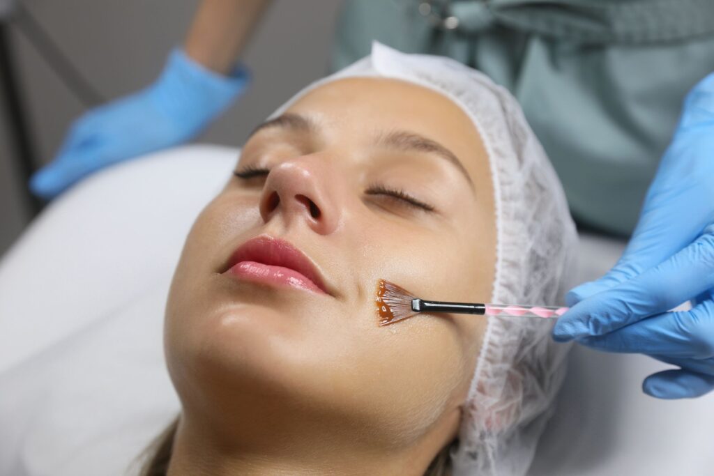 Chemical-Peel-Treatment-in-lower-parel