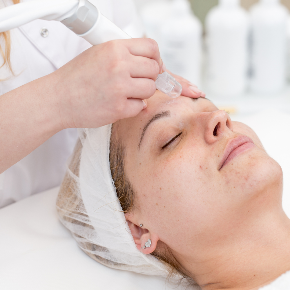 Microdermabrasion